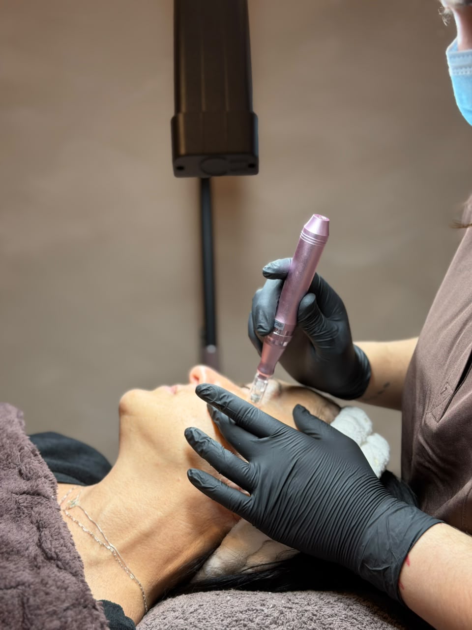 Microneedling