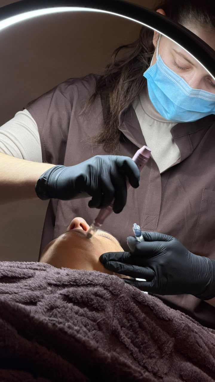 Microneedling