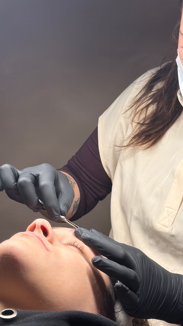 Dermaplaning